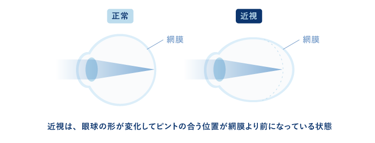 画面を見るときの正しい姿勢
